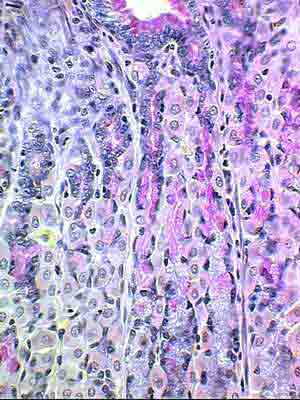 Слизистые клетки в эпителии желез и поверхности слизистой оболочки  фундального отдела желудка