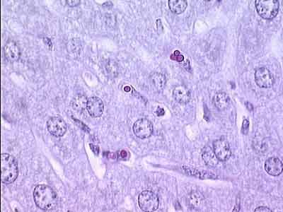 Гепатоциты и звездчатые макрофаги